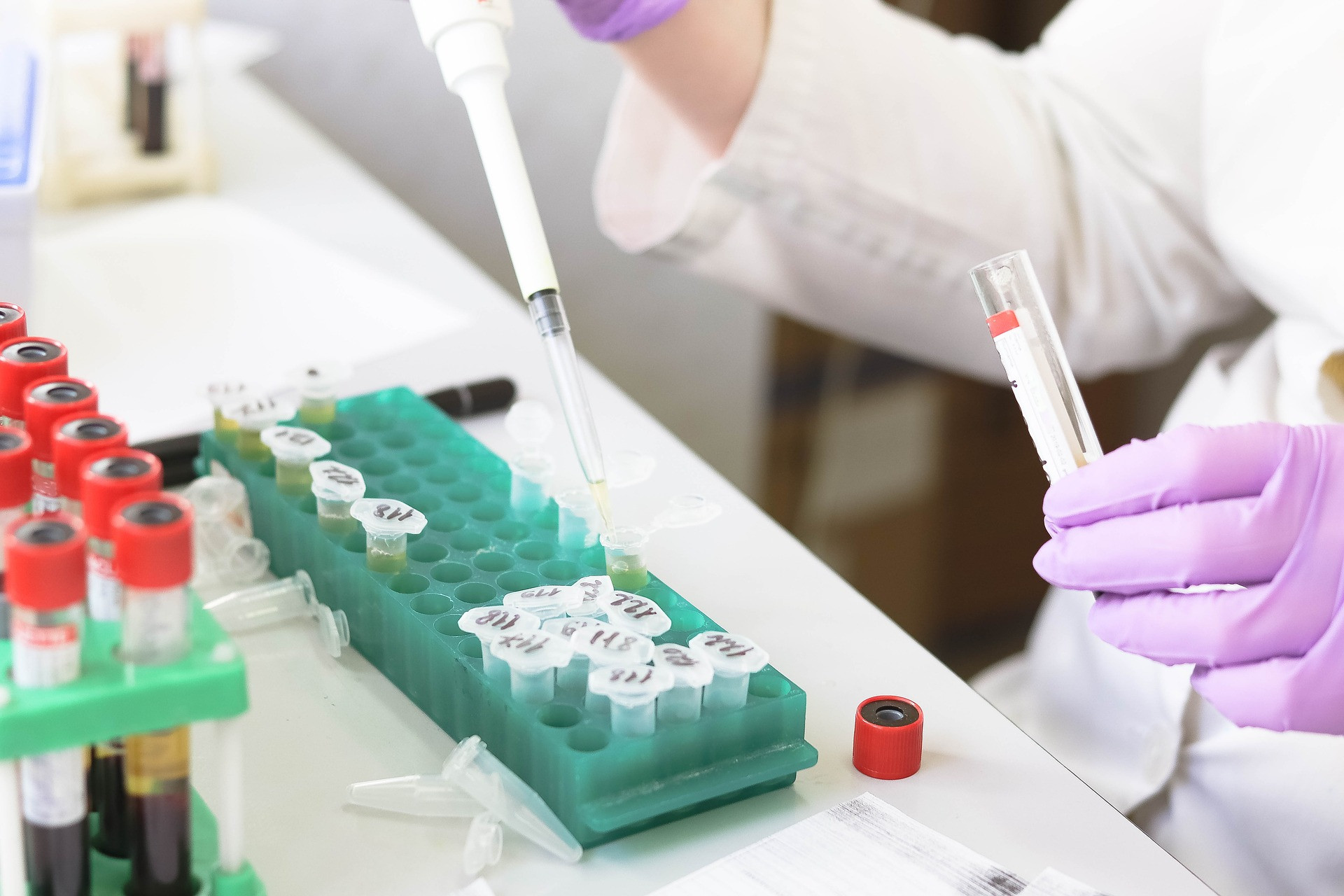  Recherche sur le cancer du sein dans l'UE, une mise en avant essentielle
